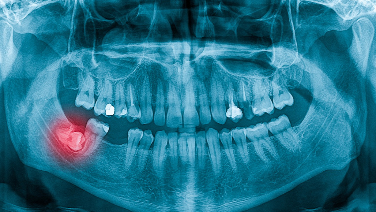 ZAZUBY (6)
